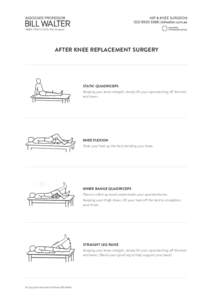 After Knee Replacement Surgery  Static Quadriceps Keeping your knee straight, slowly lift your operated leg off the bed and lower.