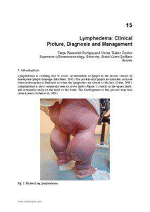 15 Lymphedema: Clinical Picture, Diagnosis and Management