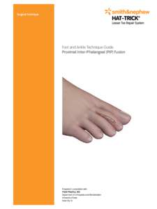 Extensor expansion / Muscular system / Tendons / Interphalangeal articulations of hand / Phalanx bone / Proximal phalanges / Finger / Bone fracture / Pip / Anatomy / Hand / Skeletal system