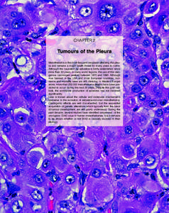 CHAPTER 2  Tumours of the Pleura Mesothelioma is the most frequent neoplasm affecting the pleura and remains a major health threat for many years to come. Although the causation by asbestos is firmly established since mo