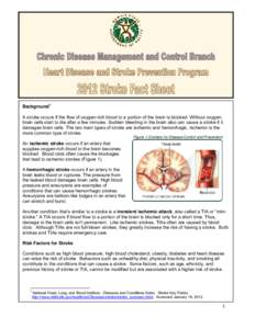 Transient ischemic attack / Cardiovascular disease / Hypertension / Obesity / Stroke Belt / Silent stroke / Medicine / Stroke / Health