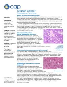 Ovarian Cancer  Endometrioid Carcinoma What is an ovarian endometrioid tumor? Definitions Endometrial: