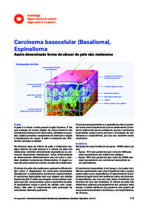 Carcinoma basocelular (Basalioma), ­Espinalioma Assim denominada forma de câncer de pele não melanoma Composição da Pele células pigmentárias (melanócitos)