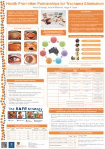 Blindness / Trachoma / Ophthalmology / Trichiasis / Hygiene / Health / Tropical diseases / Medicine