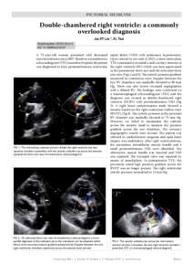 PICTORIAL MEDICINE  Double-chambered right ventricle: a commonly overlooked diagnosis Joe KT Lee *, KL Tsui