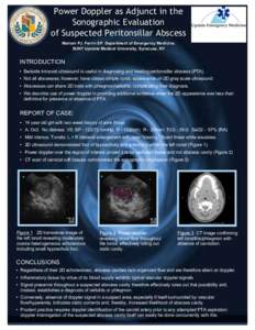 Power Doppler as Adjunct in the Sonographic Evaluation of Suspected Peritonsillar Abscess Mariani PJ, Ferrin SP. Department of Emergency Medicine, SUNY Upstate Medical University, Syracuse, NY