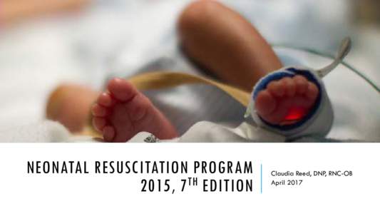 Summary of revised neonatal resuscitation guidelines