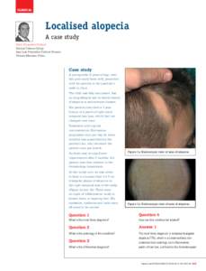 clinical  Localised alopecia A case study Pablo Fernandez-Crehuet Patricia Cabeza-Calleja