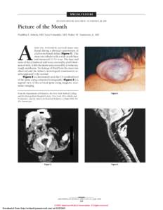 SPECIAL FEATURE SECTION EDITOR: WALTER W. TUNNESSEN, JR, MD Picture of the Month Pratibha A. Ankola, MD; Yara Fernandes, MD; Walter W. Tunnessen, Jr, MD