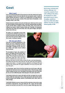 Gout What is gout? Gout is the clinical manifestation of hyperuricaemia with acute arthritis and/or gouty