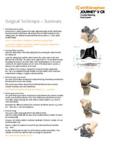 Surgical Technique – Summary 1.	 Distal femoral resection Ensure there is contact between the valgus alignment guide and the distal femur. Resection from the distal femur will measure from the depth indicated on the cu