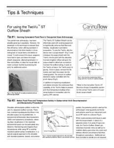 Tips & Techniques For using the TwoVu™ ST Outflow Sheath Tip #1:  Gaining Consistent Fluid Flow in Two-portal Knee Arthroscopy