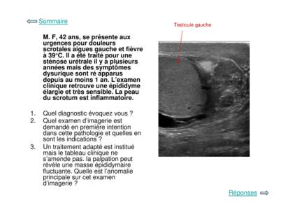 Sommaire  Testicule gauche M. F, 42 ans, se présente aux urgences pour douleurs