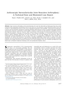 Arthroscopic Sternoclavicular Joint Resection Arthroplasty: A&nbsp;Technical Note and Illustrated Case Report