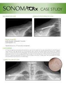 CASE STUDY PRE-OPERATIVE X-RAY IMMEDIATE POST-OPERATIVE X-RAY  Michael Huang, M.D.