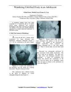 ___________________________________________ Wandering Calcified Ovary in an Adolescent Orhan Konez, Manish Goyal, Pranav K. Vyas Departments of Radiology, Aultman Hospital (OK, MG) and Children’s Hospital Medical Cente