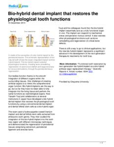 Bio-hybrid dental implant that restores the physiological tooth functions