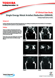 CT Clinical Case Study  Single Energy Metal Artefact Reduction (SEMAR) St George Hospital, Sydney, Australia  Background