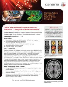 Canada Takes the Lead in Global Brain Imaging  Joins with International Partners to