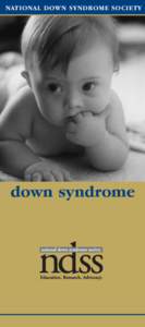 NATIONAL DOWN SYNDROME SOCIETY  down syndrome Down syndrome affects people of all