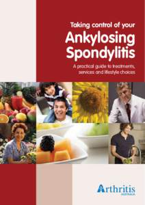 Taking control of your  Ankylosing Spondylitis A practical guide to treatments, services and lifestyle choices