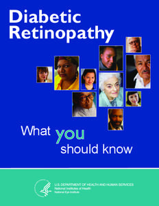 Diabetic Retinopathy What should know