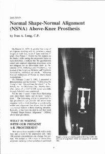 Normal Shape-Normal Alignment (NSNA) Above-Knee Prosthesis by Ivan A. Long, C P .