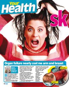 sk Organ failure nearly cost me arm and breast Doreen