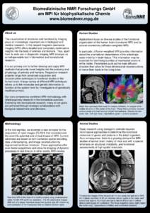 Real-time MRI / Diffusion MRI / Medical imaging / Jens Frahm / Functional magnetic resonance imaging / FLASH MRI / Magnetic resonance imaging / Medicine / Physics
