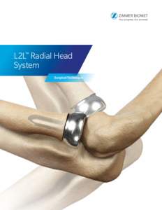 L2L™ Radial Head System Surgical Technique Table of Contents
