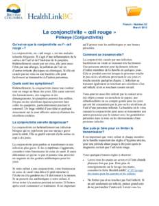 French - Number 82 March 2013 La conjonctivite « œil rouge » Pinkeye (Conjunctivitis) Qu’est-ce que la conjonctivite ou l’« œil