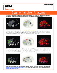 Off-the-Wall Guide  Segmental