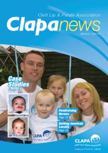 Cleft Lip & Palate Association  | ISSUE 22    [removed]Case