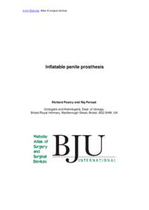 www.bjui.org. Atlas of surgical devices  Inflatable penile prosthesis