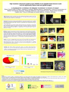 High resolution ultrasound guided surgery (HUGS) of non palpable breast lesions is safe and can significantly reduce hook-wire guided surgery 1 Nia ,  2