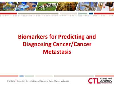Biomarkers for Predicting and Diagnosing Cancer/Cancer Metastasis Brian Kelly | Biomarkers for Predicting and Diagnosing Cancer/Cancer Metastasis