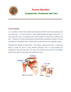 Frozen Shoulder Acupuncture Treatment and Cure Frozen Shoulder It is a condition in which the shoulder joint becomes stiff which limits the movement and can cause pain. It is more common in older people between the ages 