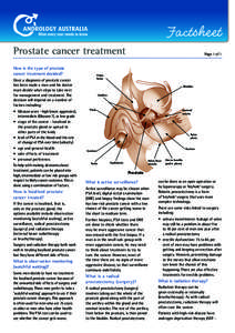 Factsheet	 Prostate cancer treatment How is the type of prostate cancer treatment decided?  Pubic