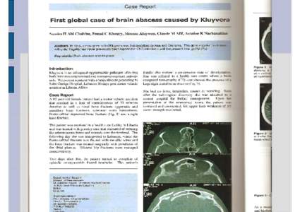 Microsoft PowerPoint - Brain abscess 281.ppt [Compatibility Mode]