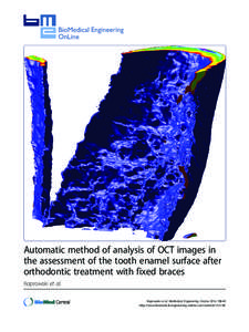 Automatic method of analysis of OCT images in the assessment of the tooth enamel surface after orthodontic treatment with fixed braces