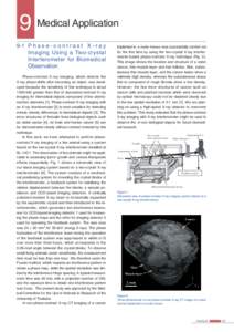 9 Medical Application 9-1 P h a s e - c o n t r a s t X - r a y Imaging Using a Two-crystal Interferometer for Biomedical Observation Phase-contrast X-ray imaging, which detects the