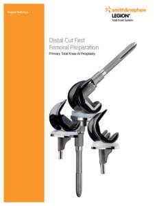 Surgical Technique  Distal Cut First Femoral Preparation Primary Total Knee Arthroplasty