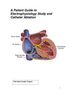 A Patient Guide to Electrophysiology Study and Catheter Ablation Peter Munk Cardiac Program