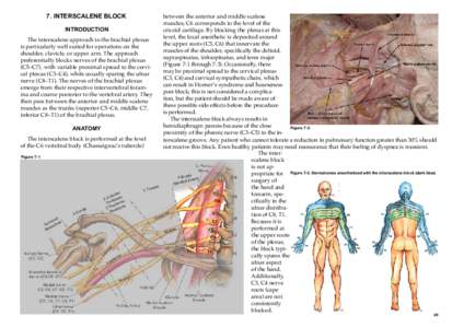 7. Interscalene Block INTRODUCTION The interscalene approach to the brachial plexus is particularly well suited for operations on the shoulder, clavicle, or upper arm. The approach preferentially blocks nerves of the bra