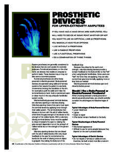 Prosthetic Devices for Upper-Extremity Amputees If you have had a hand or an arm amputated, you will need to decide at some point whether or not