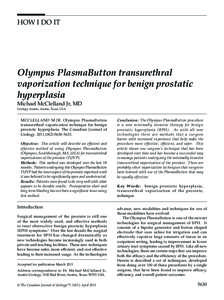 Benign prostatic hyperplasia / Prostatectomy / Catheters / Prostate / Transurethral microwave thermotherapy / Lower urinary tract symptoms / Foley catheter / Urology / Urethra / Medicine / Male reproductive system / Transurethral resection of the prostate