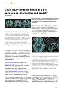 Brain injury patterns linked to post-concussion depression and anxiety