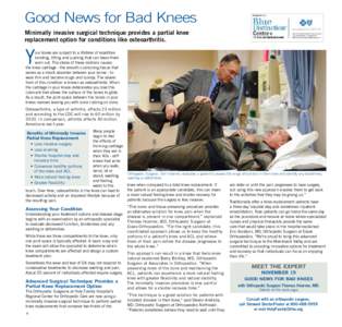 Good News for Bad Knees Minimally invasive surgical technique provides a partial knee replacement option for conditions like osteoarthritis. Y