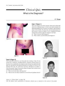 HK J Paediatr (new series) 2002;7:263  Clinical Quiz What is the Diagnosis? CY YEUNG