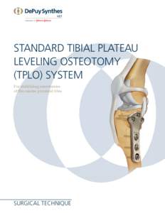 STANDARD TIBIAL PLATEAU LEVELING OSTEOTOMY (TPLO) SYSTEM For stabilizing osteotomies of the canine proximal tibia